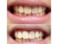emergency-dentist-box-hill-small-2