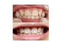 emergency-dentist-box-hill-small-1
