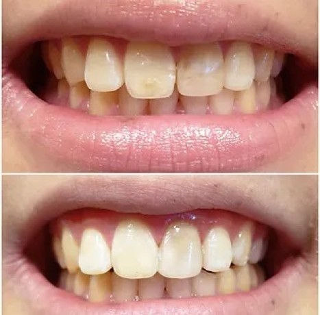 emergency-dentist-box-hill-big-2