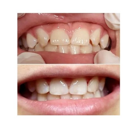 emergency-dentist-box-hill-big-1