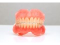 family-dentist-heyfield-small-0