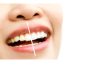 family-dentist-heyfield-small-2