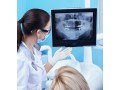 family-cosmetic-dentistry-in-beaumaris-bc-dental-small-3