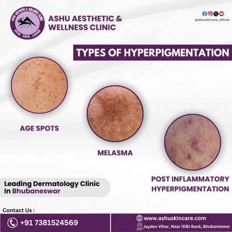dermatologist-in-bhubaneswar-odisha-skin-doctor-in-bhubaneswar-big-0