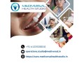 teeth-whitening-services-in-patna-small-0