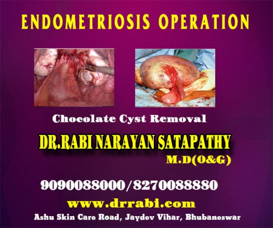 hymenoplasty-clinic-in-bhubaneswar-obstetrician-infertility-specialist-doctor-in-bhubaneswar-big-0