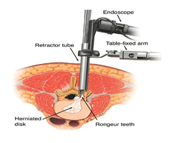 best-spine-surgoen-in-noida-big-0