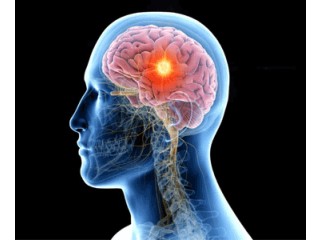 Brain Tumour Surgery in Vaishali