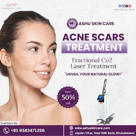 acne-scars-skin-care-hospital-in-bhubaneswar-best-skin-doctor-in-bhubaneswar-big-0