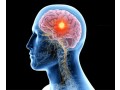 best-neurosurgeon-in-ghaziabad-small-0