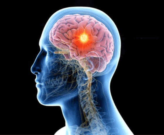 best-neurosurgeon-in-ghaziabad-big-0