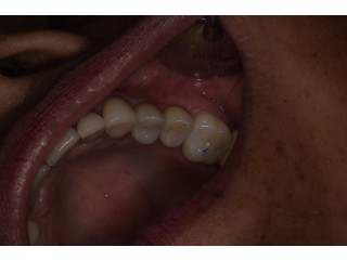 Holistic Dentist in Mexico – Natural, Biocompatible Care for Your Health and Smile