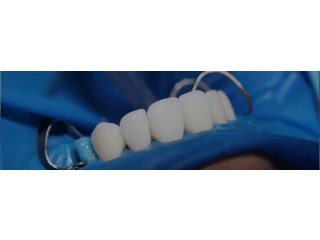 Transform your smile and appeal with steadfast Cosmetic dentist in Tijuana
