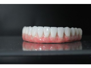 Full Mouth Dental Implants in Mexico with Teeth Savers