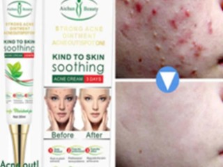 acne-freckle-cream-in-pakistan-medicated-cream-for-freckles-aichun-beauty-03000479274