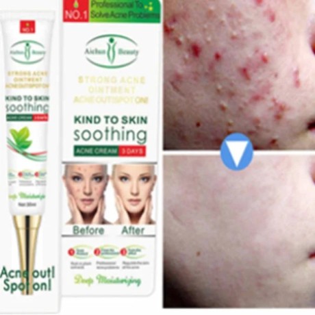 acne-freckle-cream-in-pakistan-medicated-cream-for-freckles-aichun-beauty-03000479274-big-0
