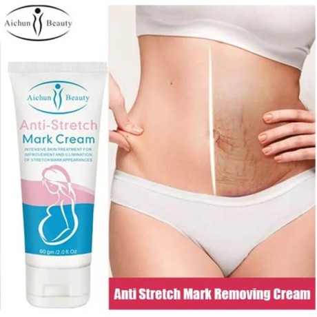 anti-stretch-marks-cream-in-pakistan-anti-stretch-marks-cream-for-pregnancy-aichun-beauty-03000479274-big-0