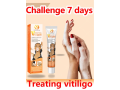 vitiligo-ointment-remove-ringworm-ship-mart-best-vitiligo-treatment-03208727951-small-0