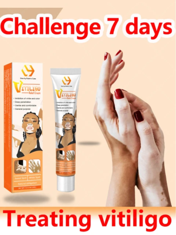 vitiligo-ointment-remove-ringworm-ship-mart-treatment-cream-03208727951-big-0