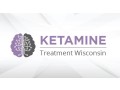 ketamine-therapy-wisconsin-small-0