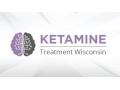 ketamine-therapy-wisconsin-small-0