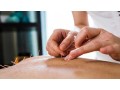 best-fertility-acupuncture-nyc-small-0