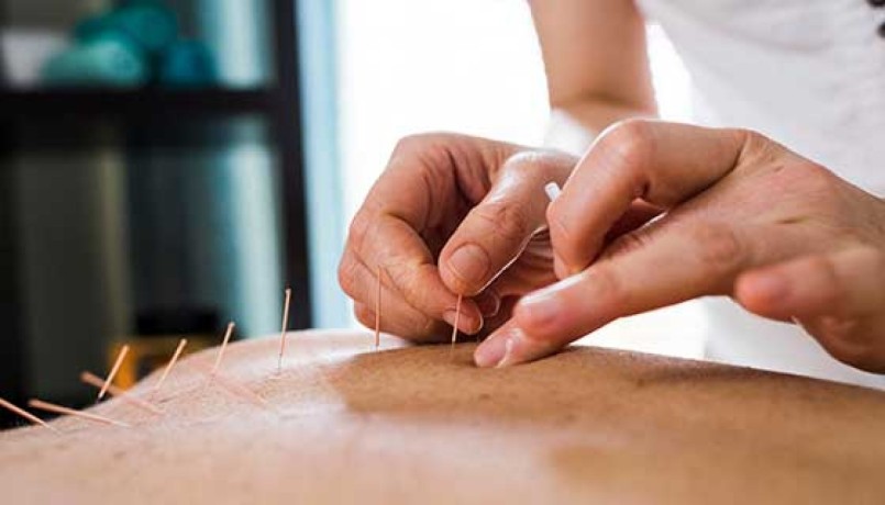 best-fertility-acupuncture-nyc-big-0