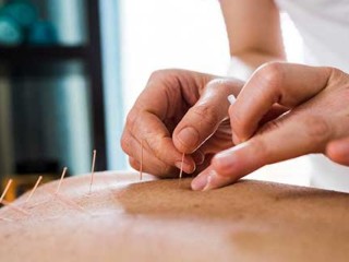 best-fertility-acupuncture-nyc