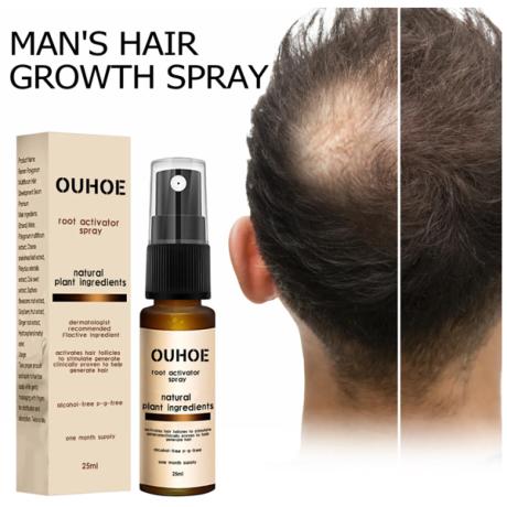 ouhoe-root-activator-hair-spray-in-pakistan-wellmart-big-0