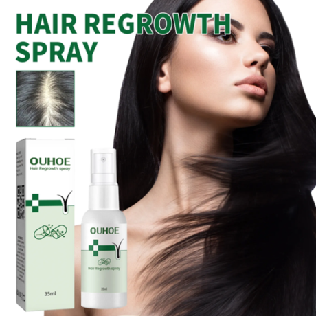 ouhoe-hair-regrowth-spray-in-pakistan-wellmart-923208727951-big-0