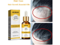 ouhoe-ginger-prevent-hair-loss-essential-oil-in-pakistan-wellmart-923208727951-small-0
