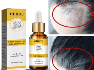 ouhoe-ginger-prevent-hair-loss-essential-oil-in-pakistan-wellmart-923208727951