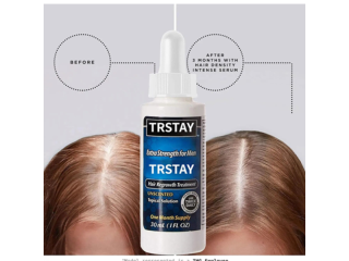 Trstay Hair Regrowth Treatment Oil In Pakistan Wellmart +923208727951