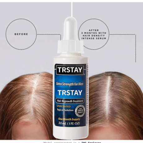trstay-hair-regrowth-treatment-oil-in-pakistan-wellmart-923208727951-big-0