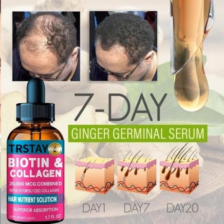 trstay-biotin-collagen-serum-in-pakistan-wellmart-923208727951-big-0