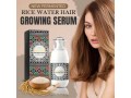 sevich-rice-water-hair-growth-spray-in-pakistan-wellmart-923208727951-small-0