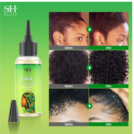 sevich-chebe-brand-oil-in-pakistan-wellmart-923208727951-big-0