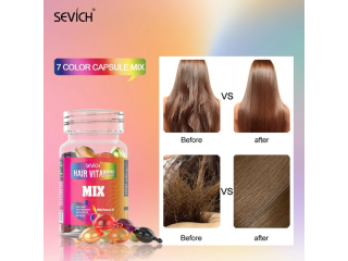 Sevich Mix Hair Vitamin Capsule Oil In Pakistan Wellmart +923208727951