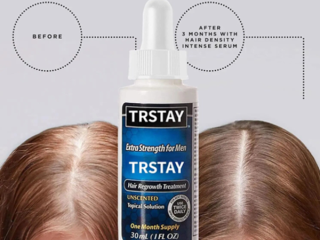 trstay-hair-regrowth-treatment-oil-in-pakistan-wellmart-923208727951
