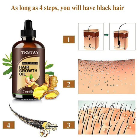 trstay-hair-growth-oil-in-pakistan-wellmart-923208727951-big-0