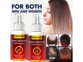 trstay-hair-growth-herbal-spray-in-pakistan-wellmart-923208727951-small-0