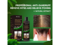 eelhoe-anti-dandruff-shampoo-in-pakistan-wellmart-923208727951-small-0