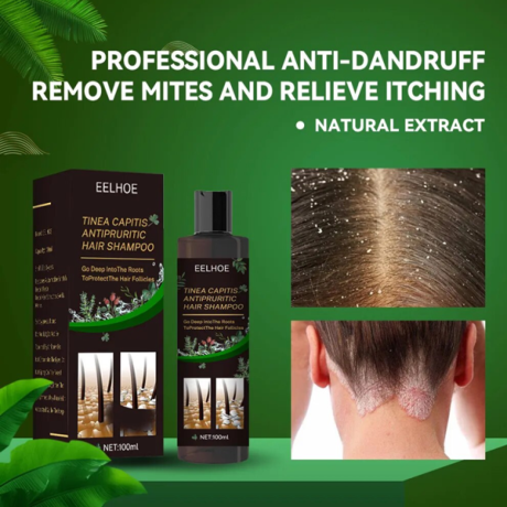 eelhoe-anti-dandruff-shampoo-in-pakistan-wellmart-923208727951-big-0