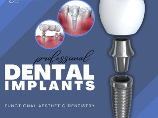 experience-superior-dental-implant-solutions-in-summerlin-at-functional-aesthetic-dentistry