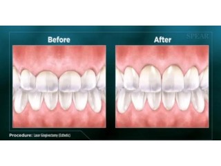 Summerlin Dental Care offers advanced laser dentistry that can transform your smile.