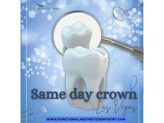 Same-Day Crowns in Las Vegas at Functional Aesthetic Dentistry