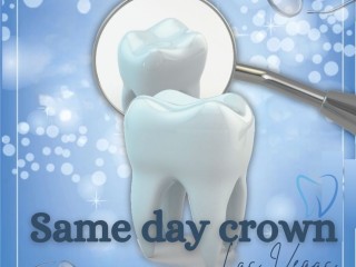 same-day-crowns-in-las-vegas-at-functional-aesthetic-dentistry