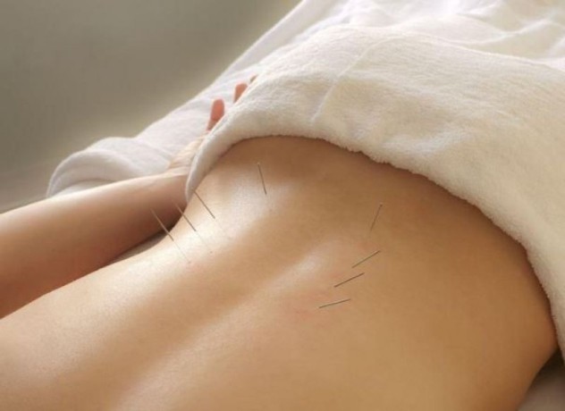 midtown-acupuncture-big-0
