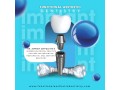 restore-your-smile-with-dental-implants-in-summerlin-small-0