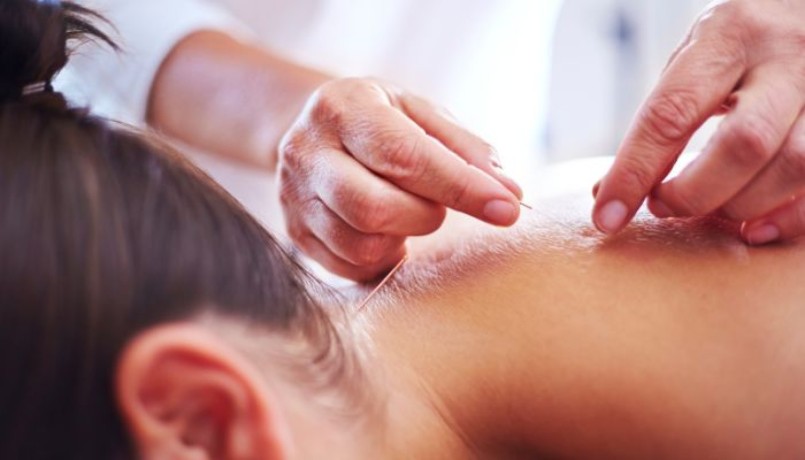 acupuncture-for-ivf-support-big-0